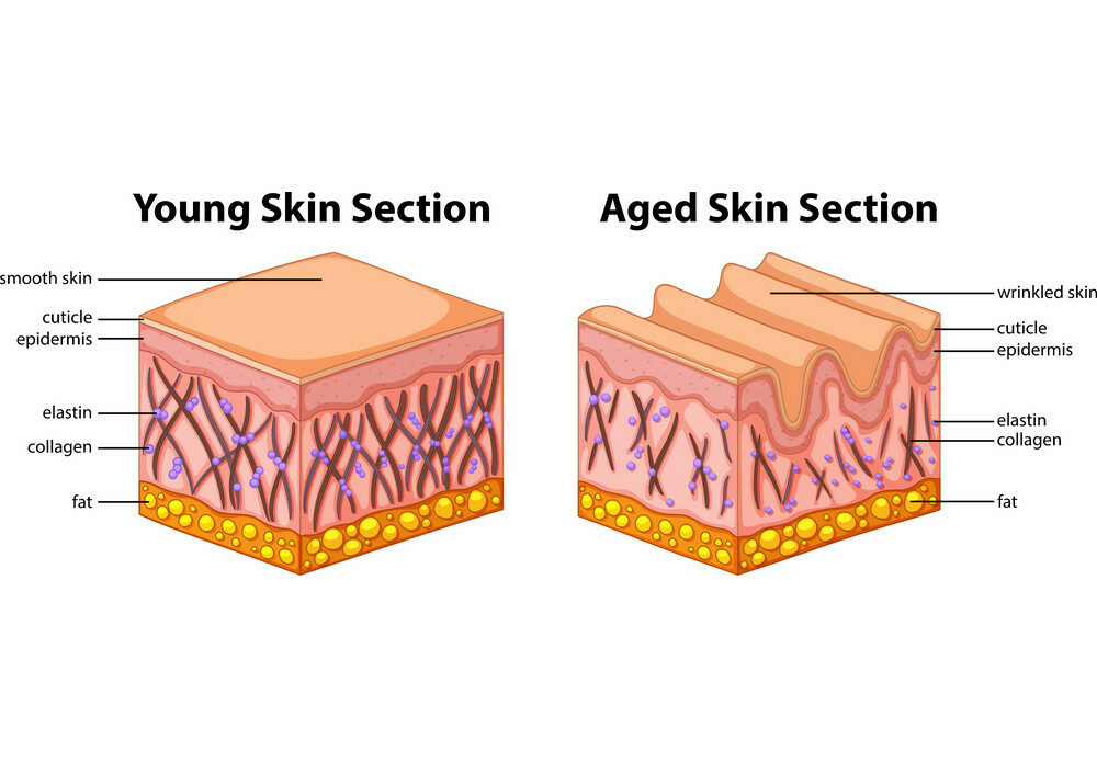 از دست رفتن کلاژن و الاستین پوست منجر به شل و پژمرده شدن پوست و ایجاد خطوط و چروکهایی در ساختمان آن می‌شود.